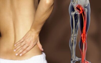 La ciática en el Ayurveda