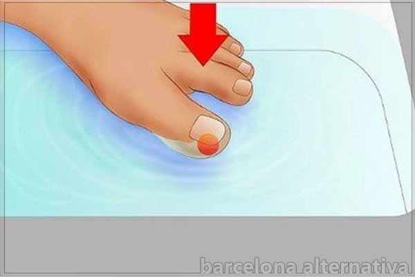 Ayuda para una uña encarnada