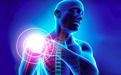 Hombro congelado (o Capsulitis adhesiva)